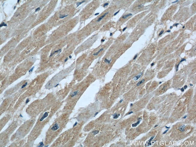 COXIV Antibody in Immunohistochemistry (Paraffin) (IHC (P))