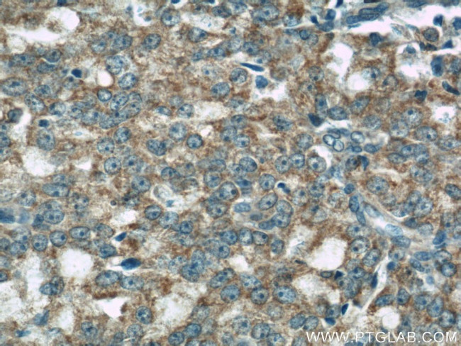 COXIV Antibody in Immunohistochemistry (Paraffin) (IHC (P))