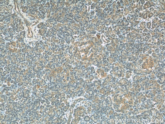 COXIV Antibody in Immunohistochemistry (Paraffin) (IHC (P))