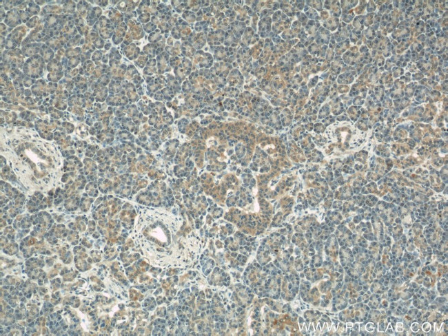 COXIV Antibody in Immunohistochemistry (Paraffin) (IHC (P))