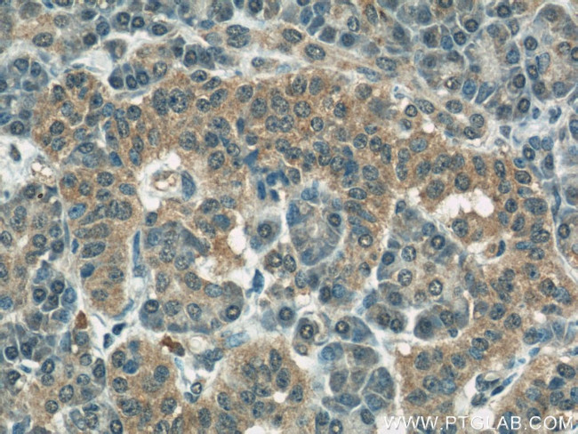 COXIV Antibody in Immunohistochemistry (Paraffin) (IHC (P))