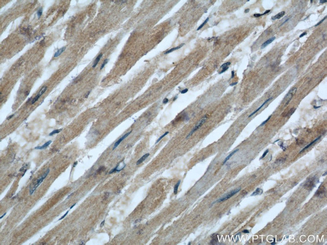 COXIV Antibody in Immunohistochemistry (Paraffin) (IHC (P))