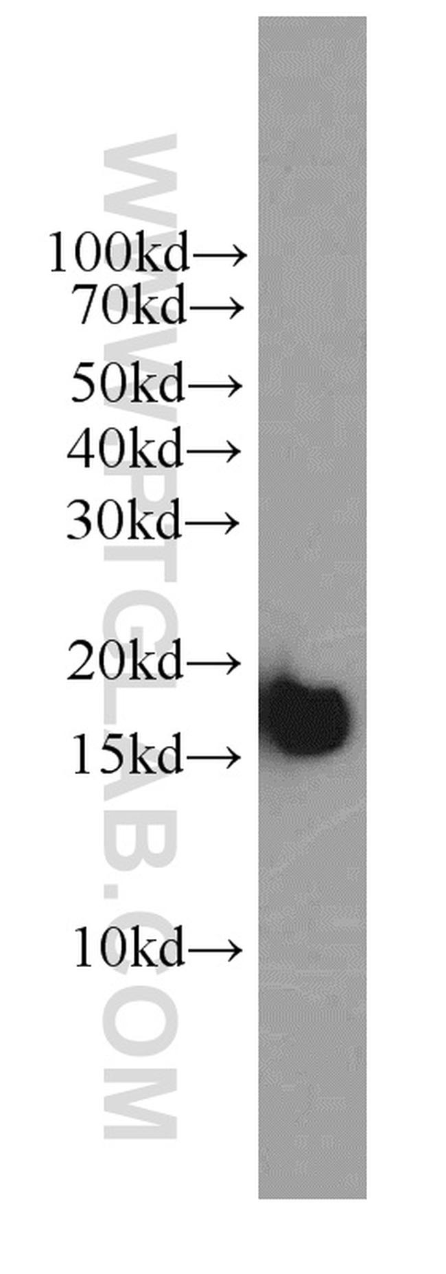 COXIV Antibody in Western Blot (WB)