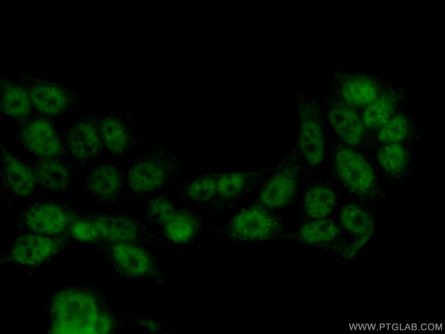 TFIP11 Antibody in Immunocytochemistry (ICC/IF)