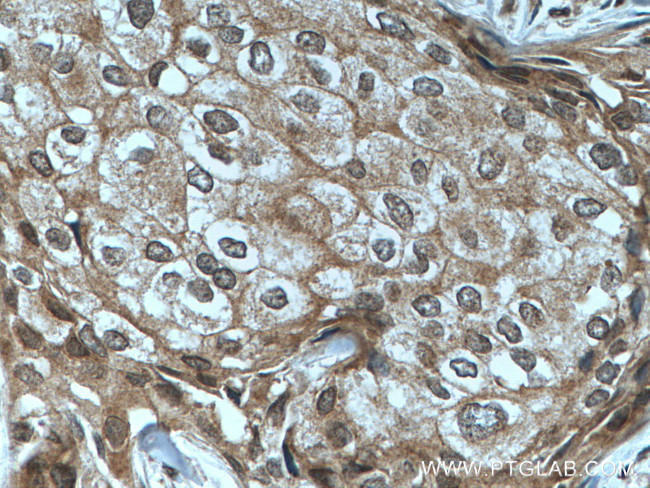 TFIP11 Antibody in Immunohistochemistry (Paraffin) (IHC (P))