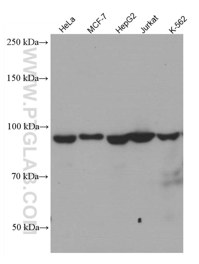 TFIP11 Antibody in Western Blot (WB)