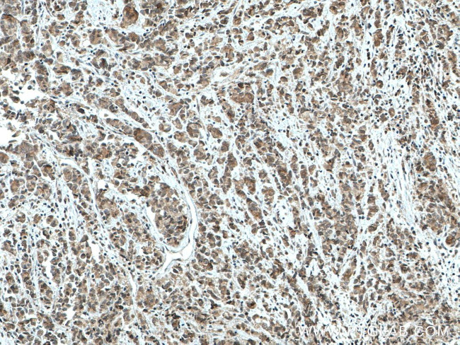 TFIP11 Antibody in Immunohistochemistry (Paraffin) (IHC (P))