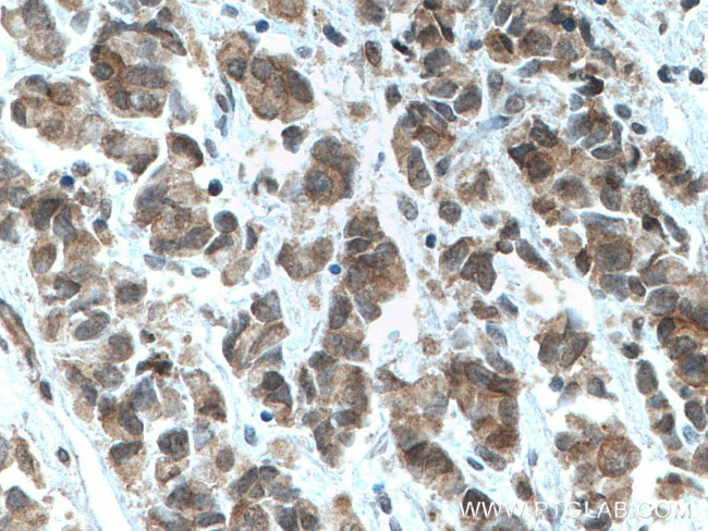 TFIP11 Antibody in Immunohistochemistry (Paraffin) (IHC (P))