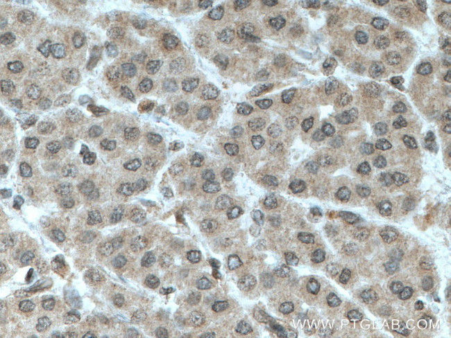 TFIP11 Antibody in Immunohistochemistry (Paraffin) (IHC (P))