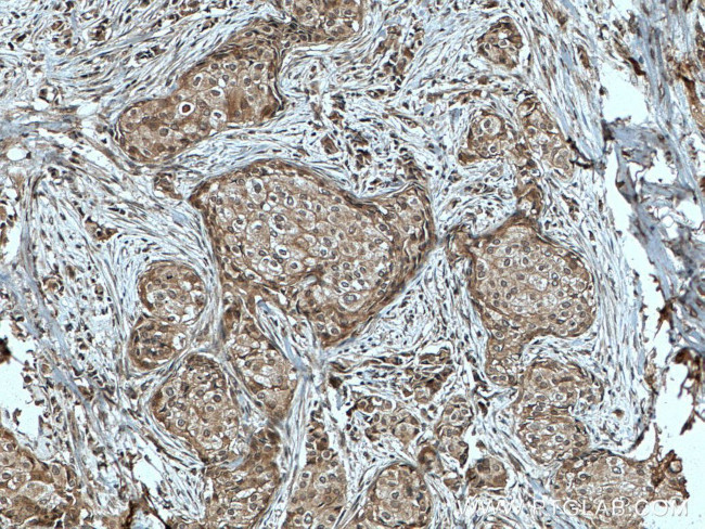 TFIP11 Antibody in Immunohistochemistry (Paraffin) (IHC (P))