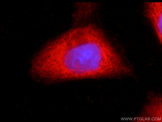 CSK Antibody in Immunocytochemistry (ICC/IF)