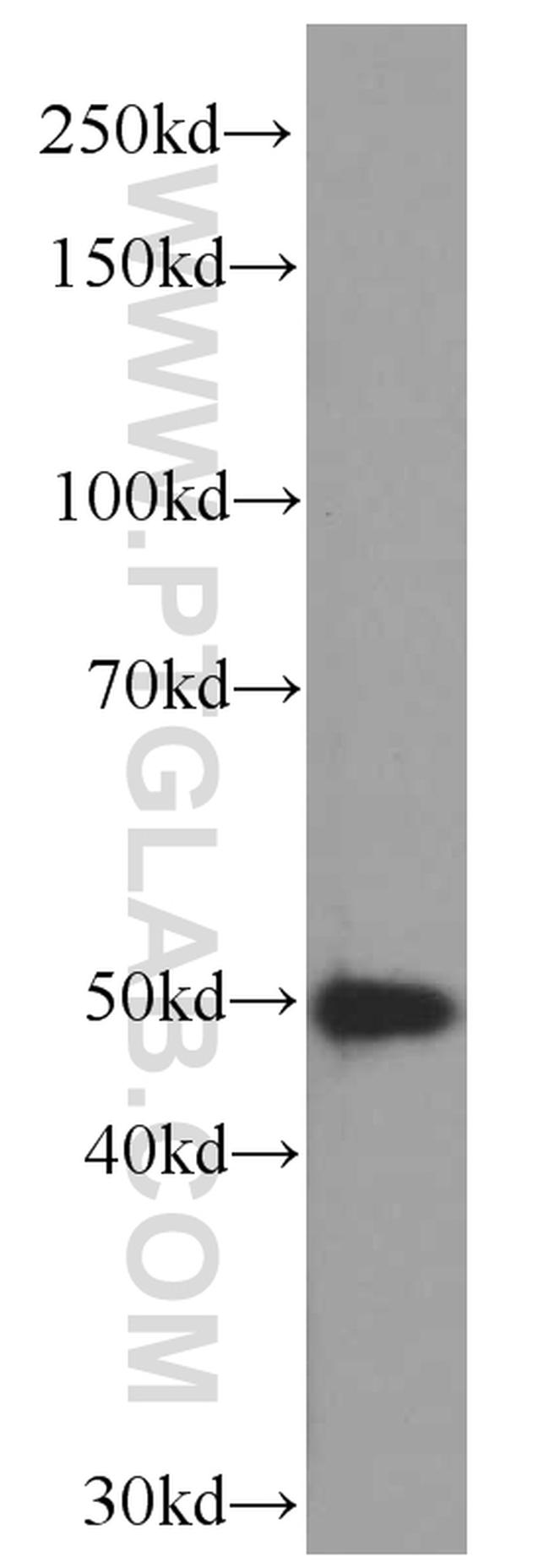 CSK Antibody in Western Blot (WB)