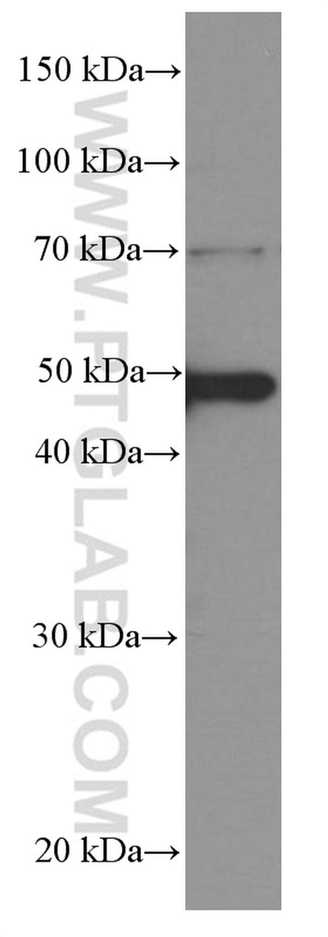 CSK Antibody in Western Blot (WB)