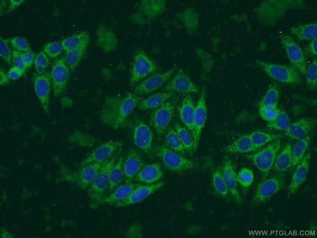 ECHS1 Antibody in Immunocytochemistry (ICC/IF)