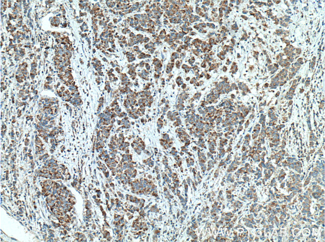 ECHS1 Antibody in Immunohistochemistry (Paraffin) (IHC (P))