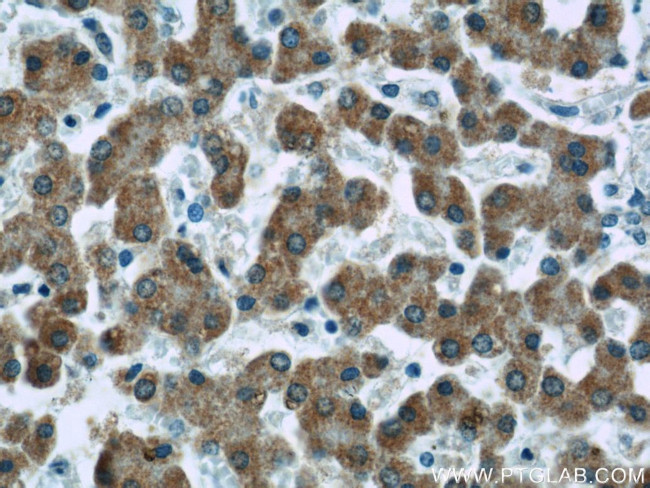 ECHS1 Antibody in Immunohistochemistry (Paraffin) (IHC (P))