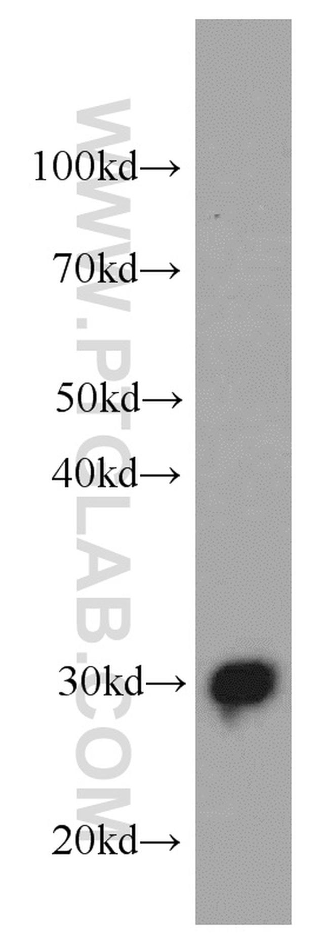 ECHS1 Antibody in Western Blot (WB)