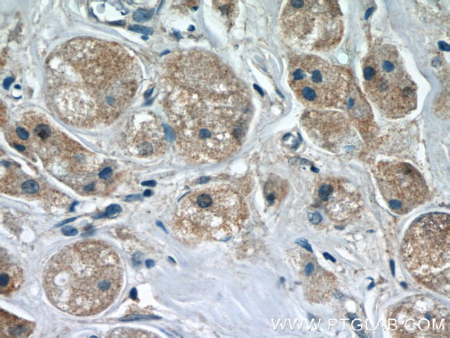 FUT8 Antibody in Immunohistochemistry (Paraffin) (IHC (P))