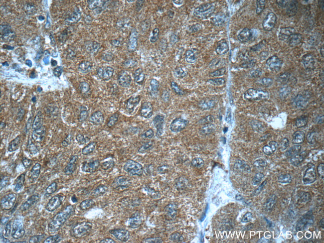 FUT8 Antibody in Immunohistochemistry (Paraffin) (IHC (P))