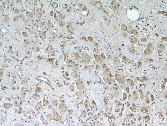 FUT8 Antibody in Immunohistochemistry (Paraffin) (IHC (P))