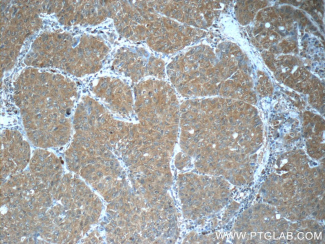 FUT8 Antibody in Immunohistochemistry (Paraffin) (IHC (P))