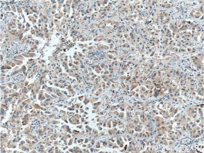 FUT8 Antibody in Immunohistochemistry (Paraffin) (IHC (P))