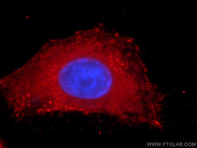 PDH E1 alpha Antibody in Immunocytochemistry (ICC/IF)