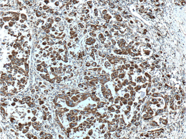 PDH E1 alpha Antibody in Immunohistochemistry (Paraffin) (IHC (P))