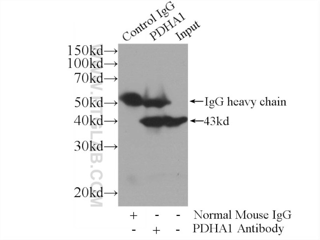 PDH E1 alpha Antibody in Immunoprecipitation (IP)