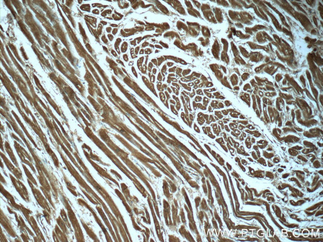 PDH E1 alpha Antibody in Immunohistochemistry (Paraffin) (IHC (P))