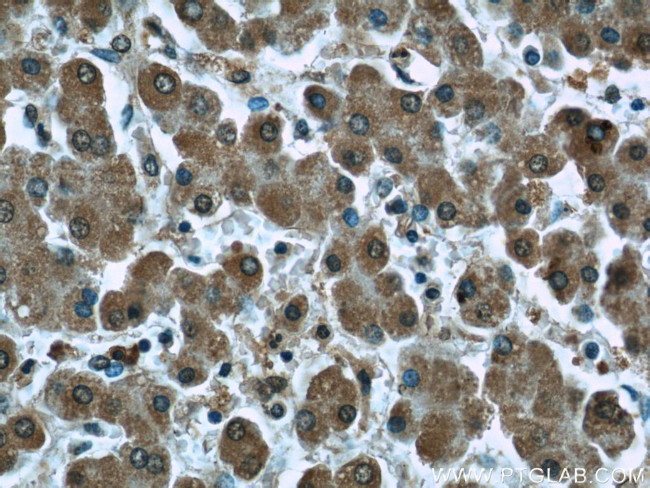 PDH E1 alpha Antibody in Immunohistochemistry (Paraffin) (IHC (P))