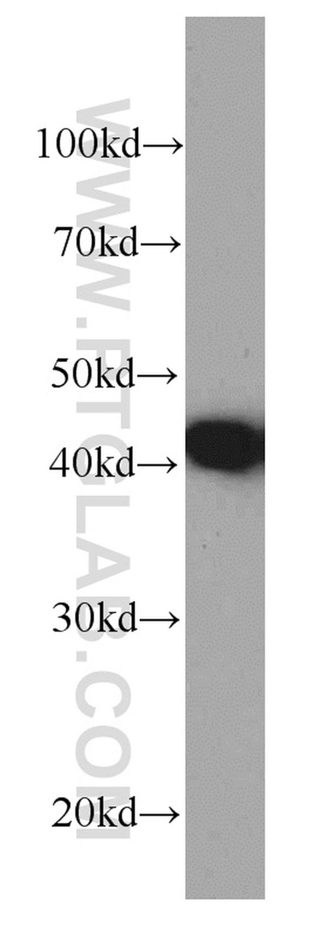 PDH E1 alpha Antibody in Western Blot (WB)