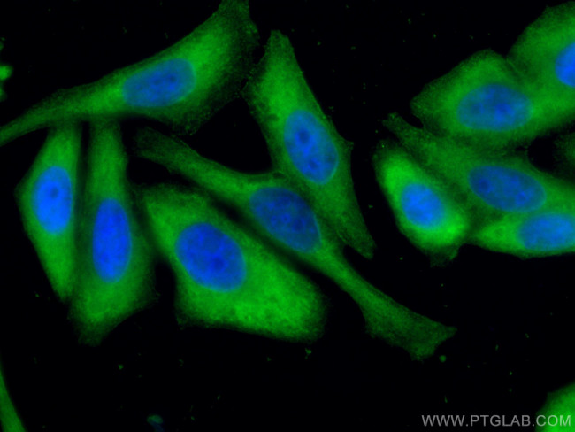 Aldolase C Antibody in Immunocytochemistry (ICC/IF)