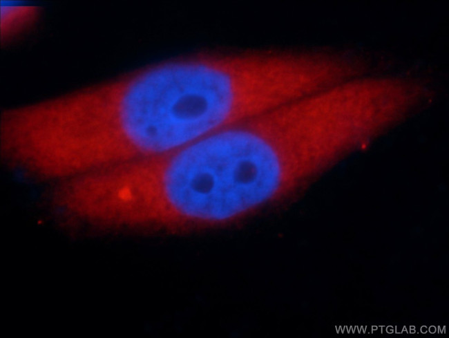 Aldolase C Antibody in Immunocytochemistry (ICC/IF)