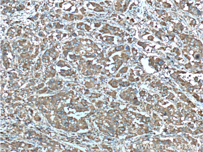 Aldolase C Antibody in Immunohistochemistry (Paraffin) (IHC (P))