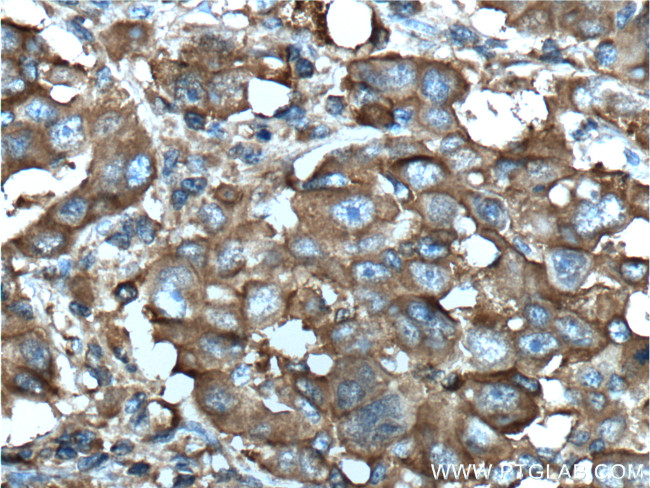 Aldolase C Antibody in Immunohistochemistry (Paraffin) (IHC (P))