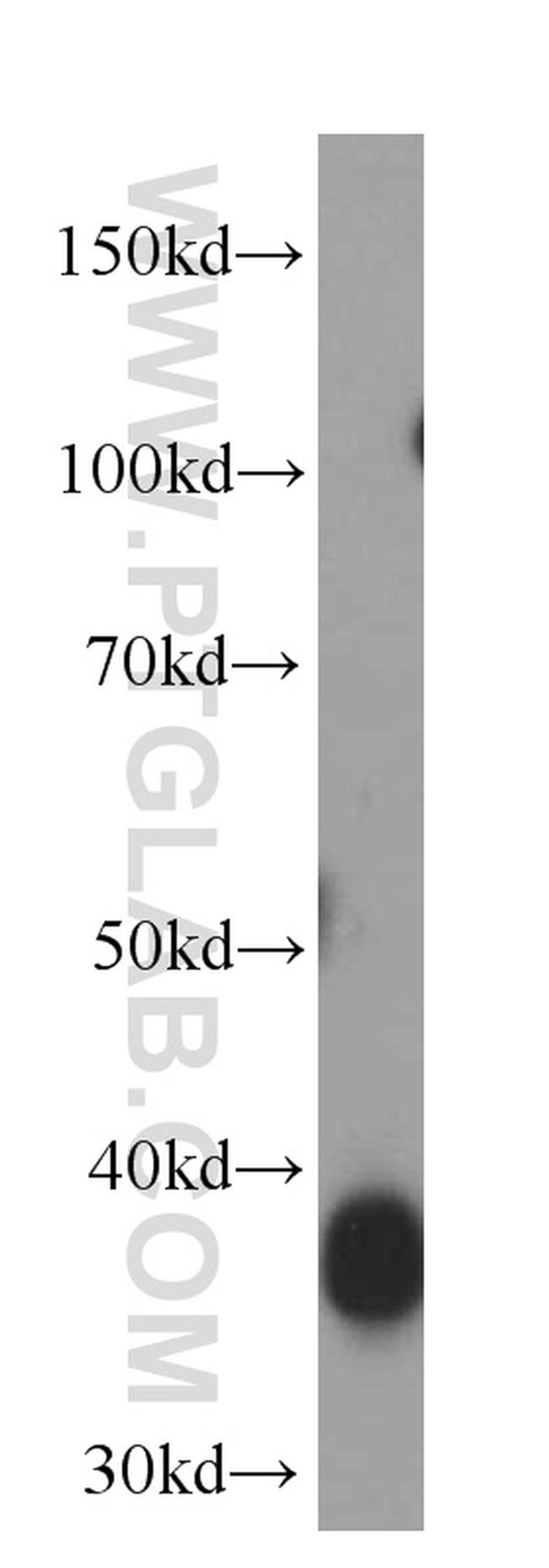 Aldolase C Antibody in Western Blot (WB)