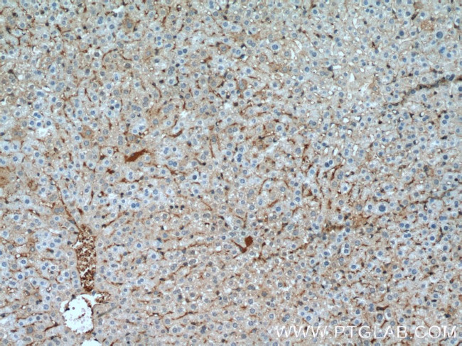 Aldolase C Antibody in Immunohistochemistry (Paraffin) (IHC (P))