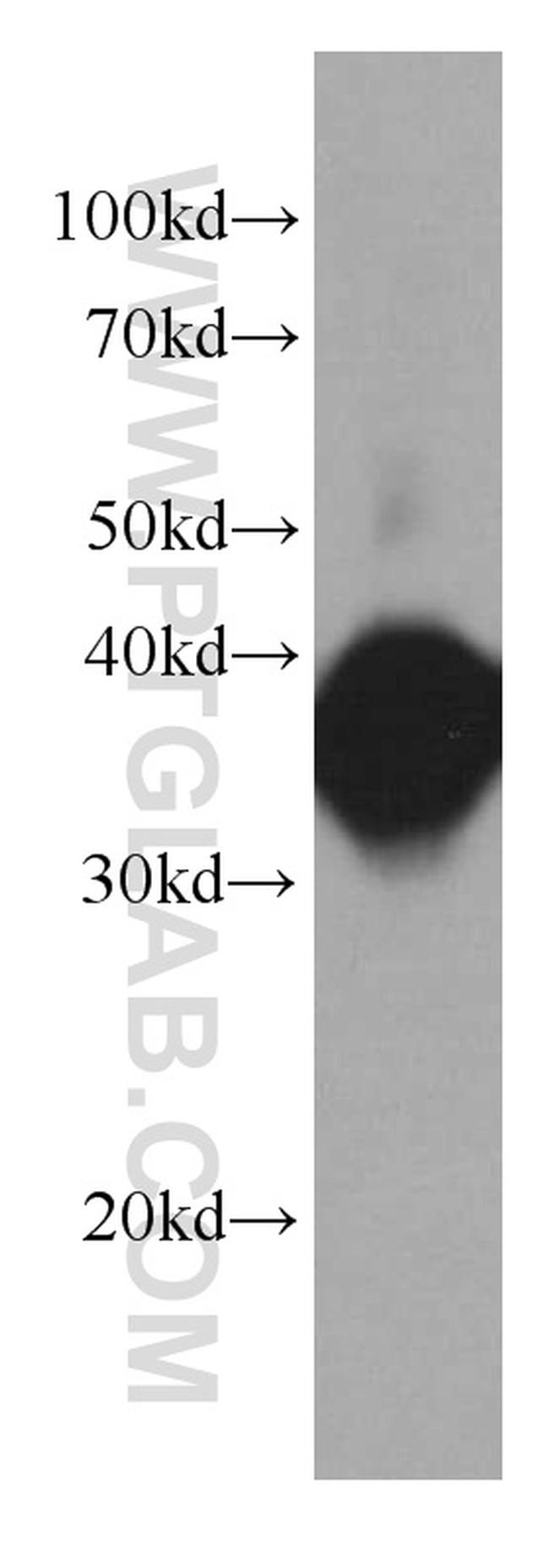 Aldolase C Antibody in Western Blot (WB)