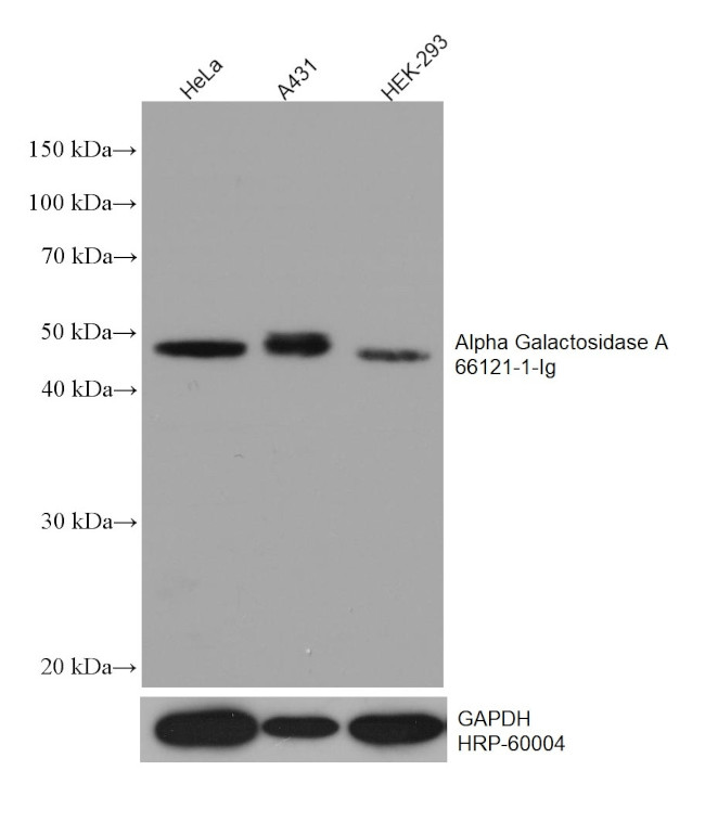 Alpha galactosidase A Antibody in Western Blot (WB)