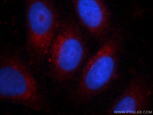 Alpha galactosidase A Antibody in Immunocytochemistry (ICC/IF)