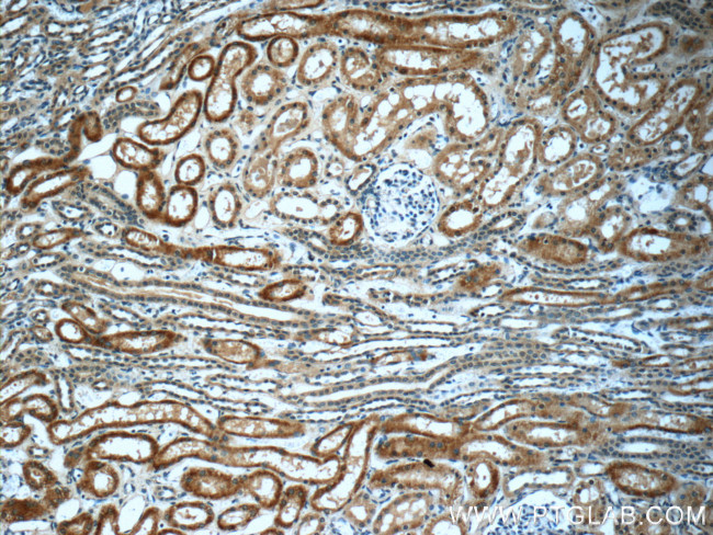 Alpha galactosidase A Antibody in Immunohistochemistry (Paraffin) (IHC (P))