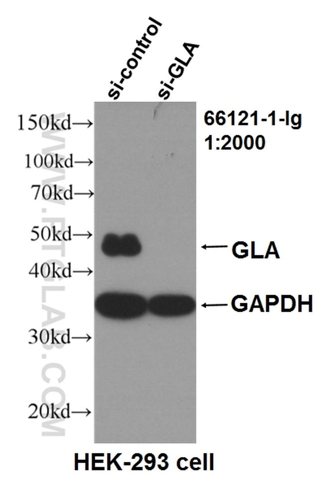 Alpha galactosidase A Antibody in Western Blot (WB)