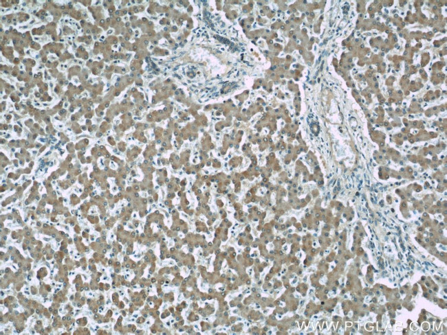 Alpha galactosidase A Antibody in Immunohistochemistry (Paraffin) (IHC (P))