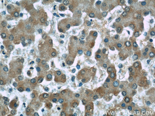 Alpha galactosidase A Antibody in Immunohistochemistry (Paraffin) (IHC (P))