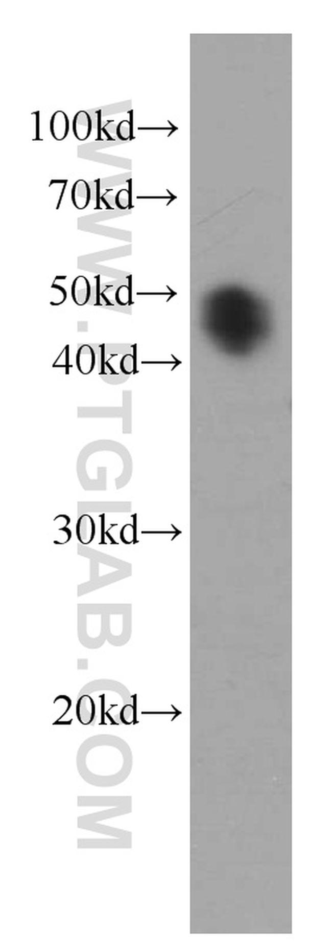 Alpha galactosidase A Antibody in Western Blot (WB)