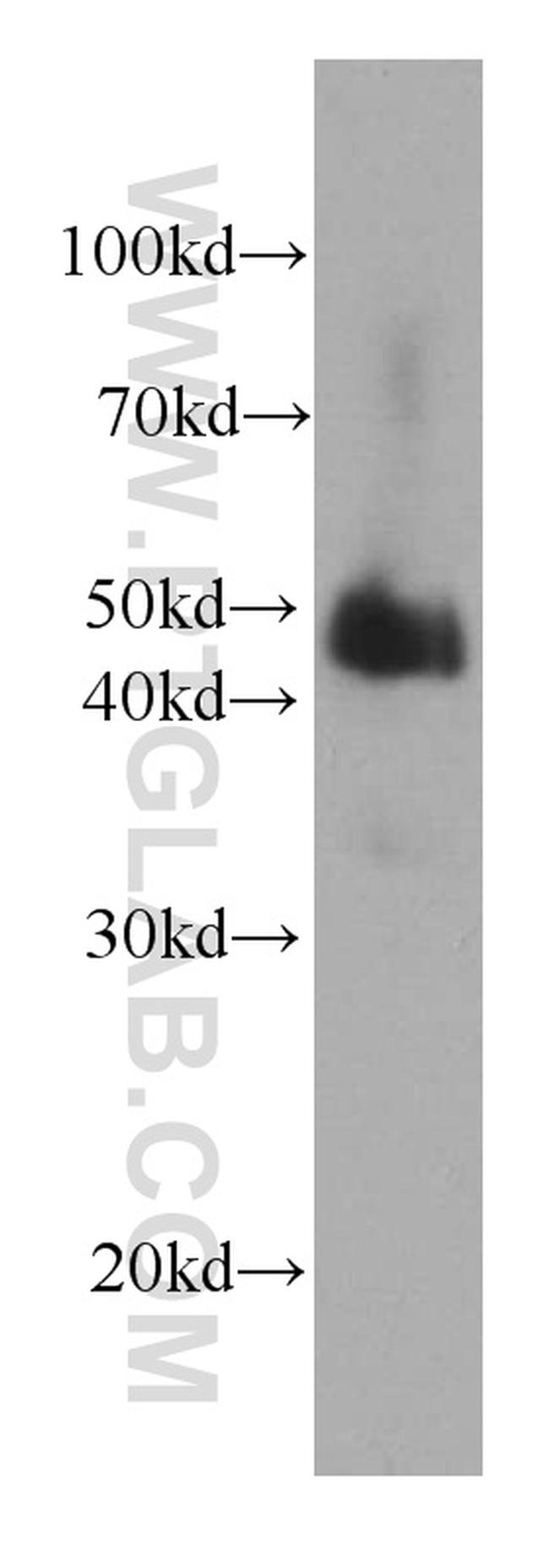 Alpha galactosidase A Antibody in Western Blot (WB)