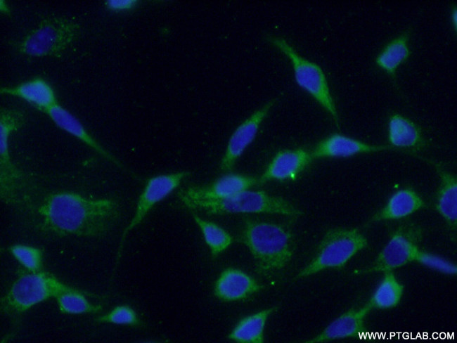 Rac1 Antibody in Immunocytochemistry (ICC/IF)