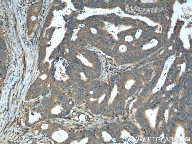 Rac1 Antibody in Immunohistochemistry (Paraffin) (IHC (P))