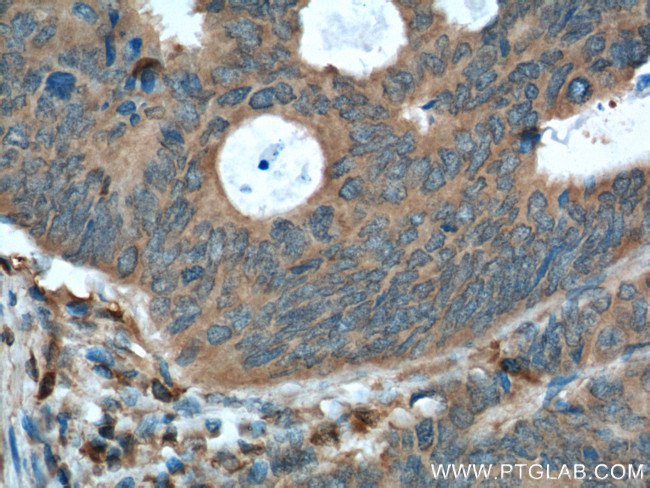 Rac1 Antibody in Immunohistochemistry (Paraffin) (IHC (P))